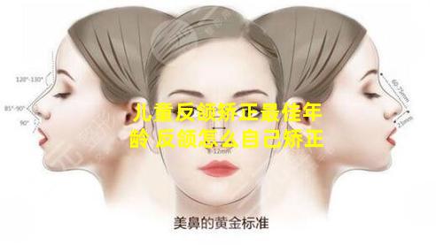 儿童反颌矫正最佳年龄 反颌怎么自己矫正